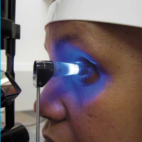 "Contact tonometry procedure at Shanthinethralaya Eye Hospital, measuring intraocular pressure"