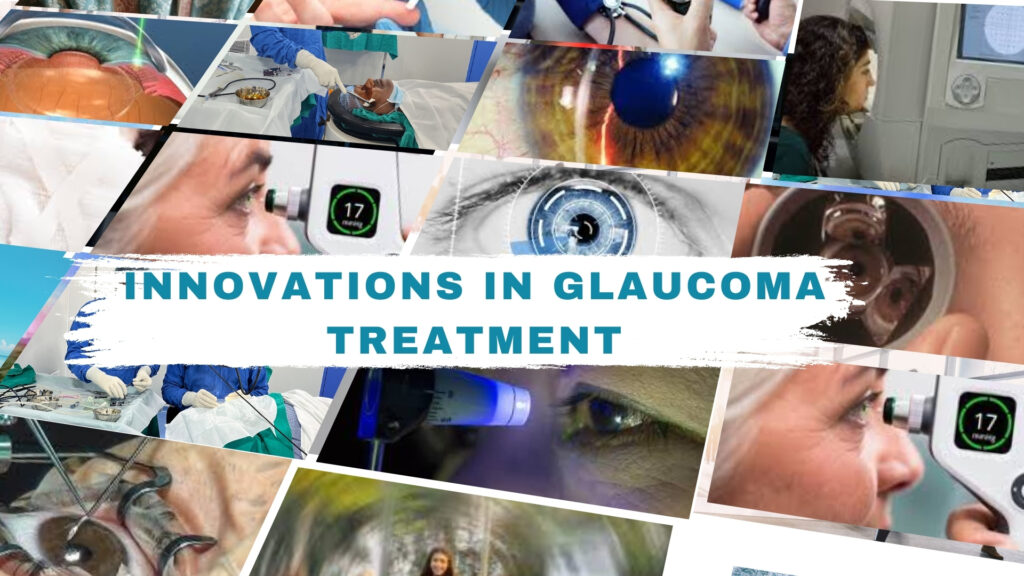 Innovations in Glaucoma Treatment explores cutting-edge approaches in glaucoma care.