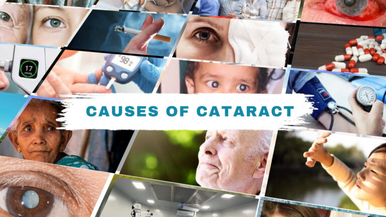 "Collage of various causes of cataract including aging, diabetes, smoking, eye trauma, medications, and genetic factors, with text overlay 'Causes of Cataract'.