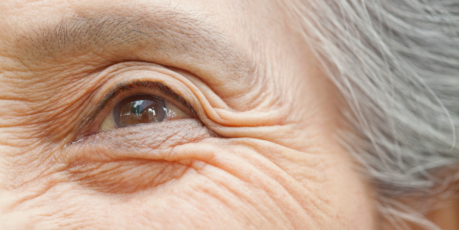 Close-up of an elderly person's eye, highlighting wrinkles, fine lines, and signs of aging around the eye.